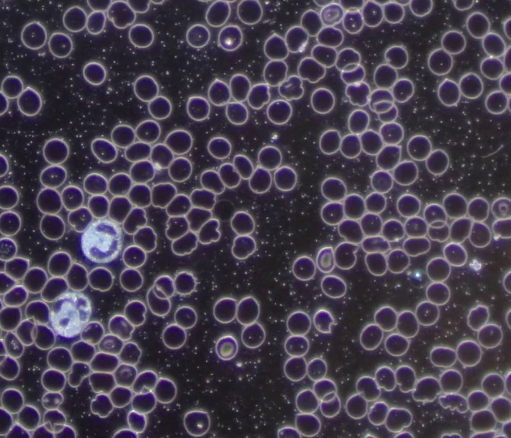 Blut unterm Dunkelfeldmikroskop